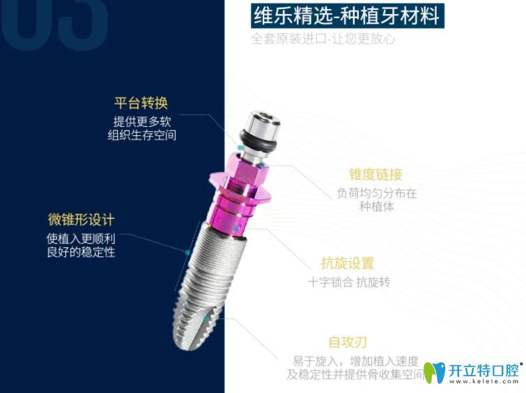 福州維樂口腔種植牙材料安全