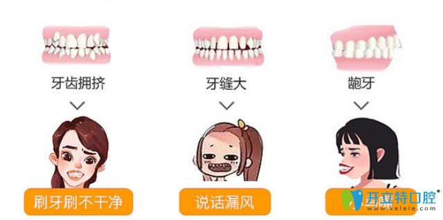 傳統(tǒng)金屬托槽固定矯正器是什么