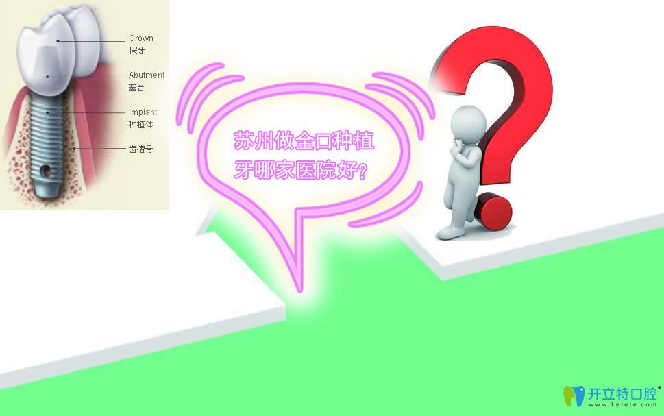 蘇州做全口種植牙哪家醫(yī)院好