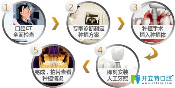 即刻種植牙修復(fù)步驟圖