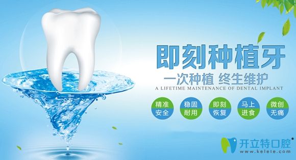 即刻種植牙技術(shù)優(yōu)勢宣傳圖