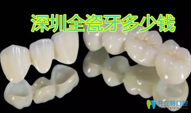 深圳全瓷牙價(jià)格