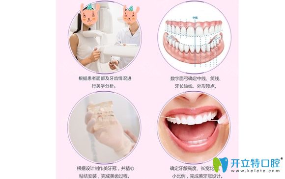 <!--<i data=20240703-sp></i>-->圣貝口腔牙齒修復特色圖
