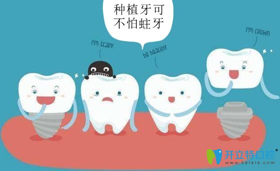 種植牙的牙冠還不怕蛀牙發(fā)生 種植牙的牙冠還不怕蛀牙發(fā)生