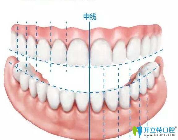成都極光口腔牙齒矯正注重美學設計