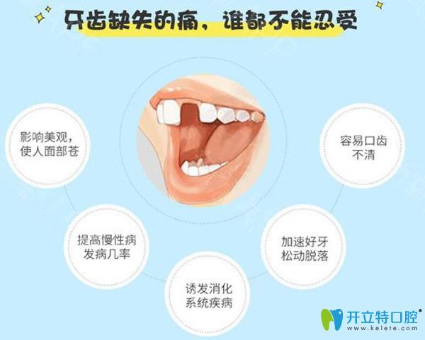 牙齒缺失的壞處