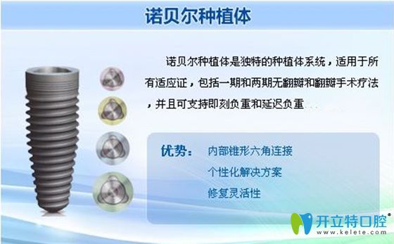 諾貝爾種植體優(yōu)勢宣傳圖 諾貝爾種植體優(yōu)勢宣傳圖