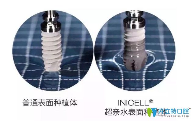 瑞士拓美種植系統(tǒng)的優(yōu)勢(shì)