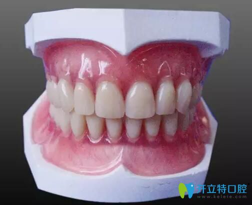 一顆牙沒(méi)有怎么鑲牙?看鑲?cè)谘纼r(jià)格含滿口義齒和種牙價(jià)格