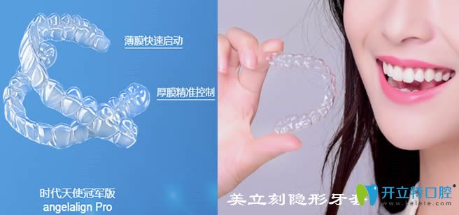國(guó)產(chǎn)隱形矯正品牌中時(shí)代天使和美立刻牙套哪個(gè)好,區(qū)別在哪