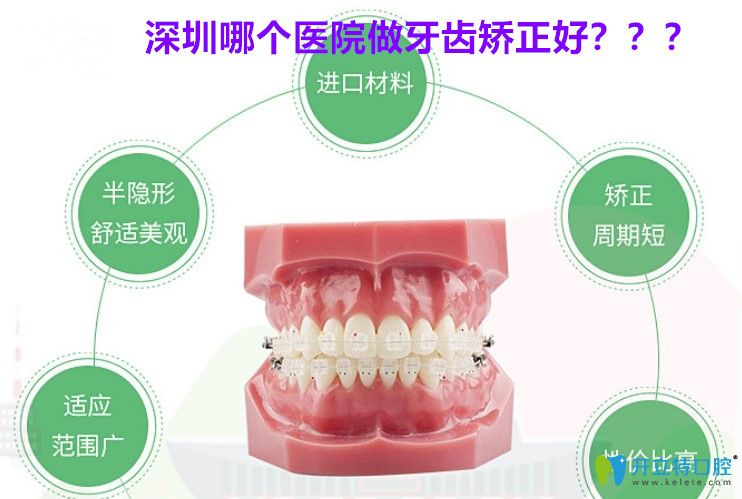 深圳牙齒矯正哪家好?市民反饋美芮口腔正畸價(jià)格不高效果好