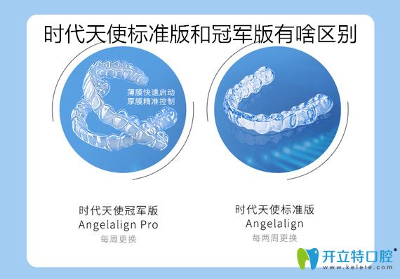 時(shí)代天使加強(qiáng)版比標(biāo)準(zhǔn)版貴嗎？看標(biāo)準(zhǔn)版和加強(qiáng)版價(jià)格區(qū)別