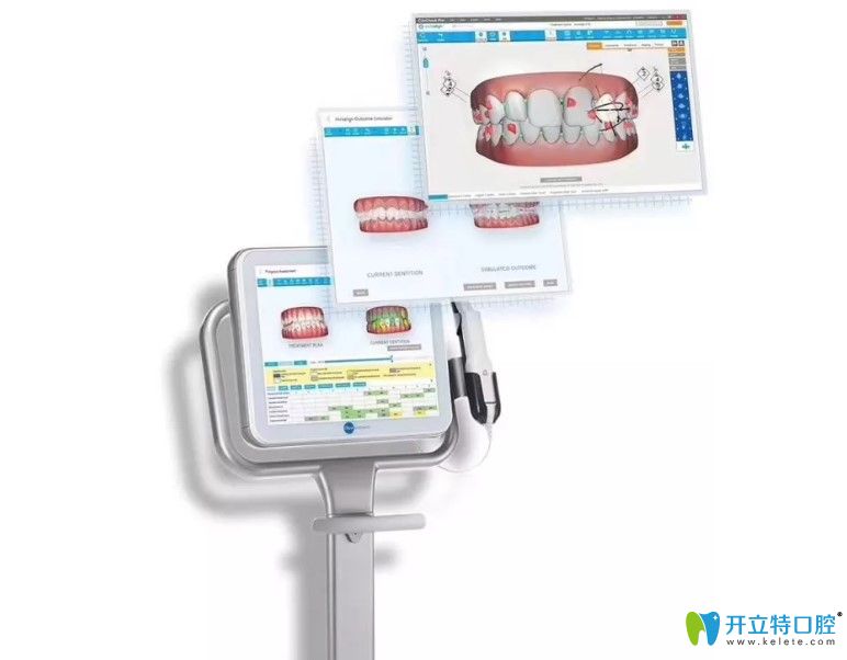 隱適美iTero口內(nèi)掃描儀是什么