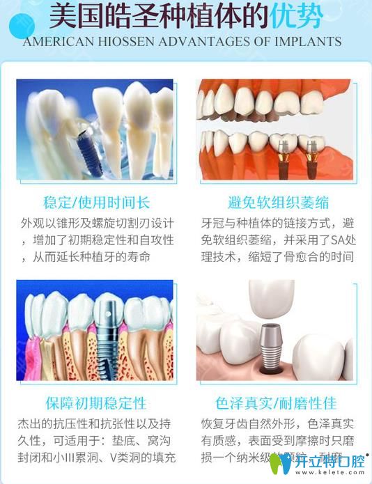 美國(guó)皓圣種植體優(yōu)勢(shì)