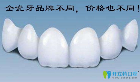 武漢做全瓷牙多少錢(qián)一顆