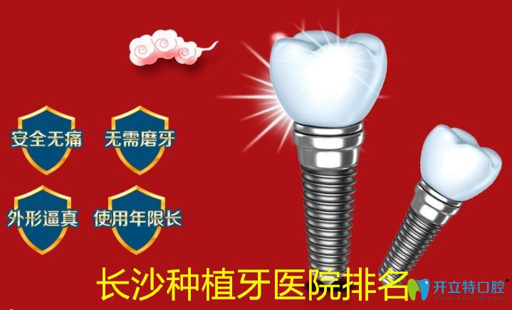 全新的長沙種植牙醫(yī)院排名及長沙牙科收費標(biāo)準(zhǔn)上線