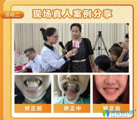 佛山華美口腔矯牙真人案例