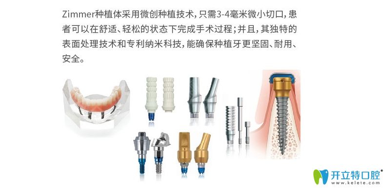 zimmer種植體簡(jiǎn)介