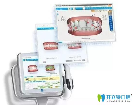 武漢壹加壹口腔正畸口掃設備