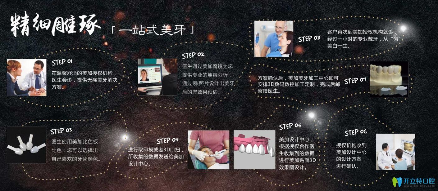 美加牙齒貼面步驟圖示