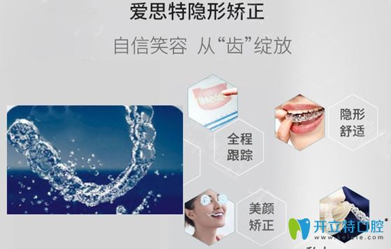 愛思特隱形矯正優(yōu)勢(shì)展示圖 愛思特隱形矯正優(yōu)勢(shì)展示圖