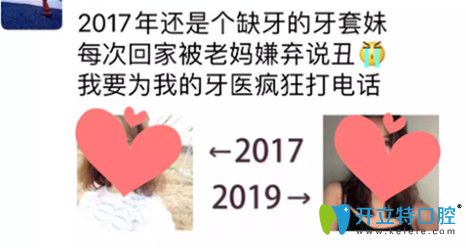 牙齒矯正好處的真實(shí)想法