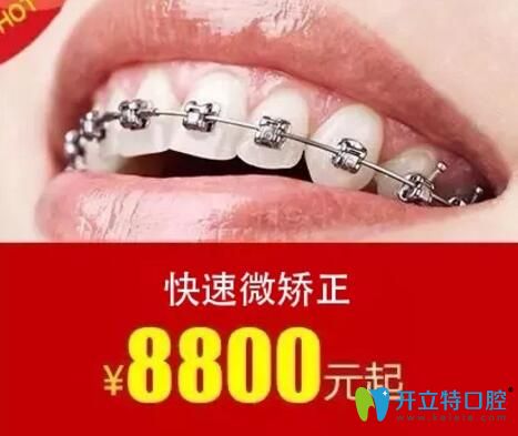 佛山華美口腔快速微矯正價格