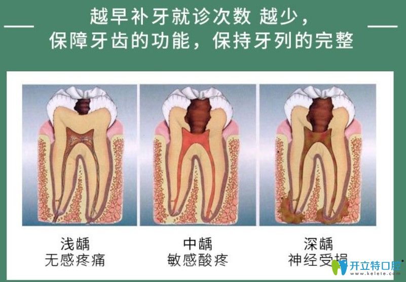 哪些牙齒情況可以補牙