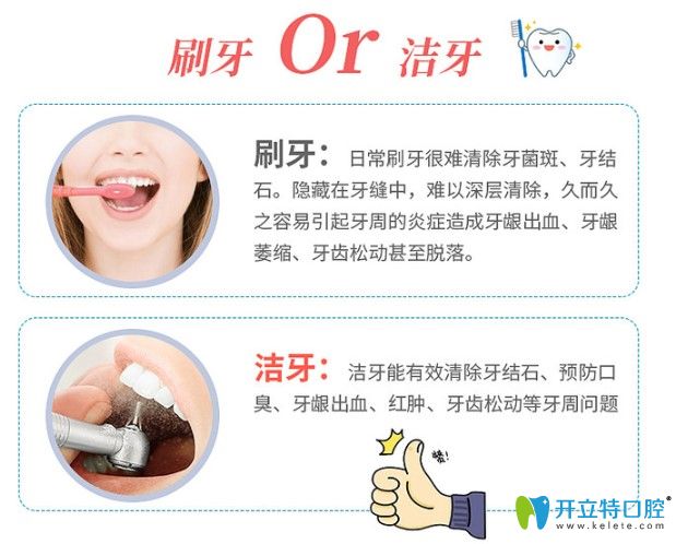 牙結(jié)石是怎樣產(chǎn)生的