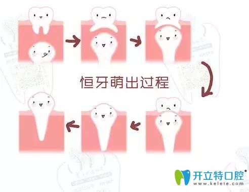 恒牙的萌出過程