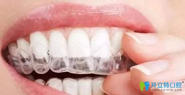 個別情況戴牙套是可以進食的