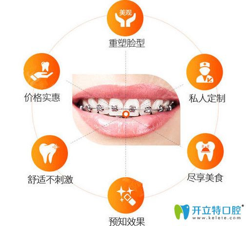 維樂(lè)口腔讓你放心選擇矯正