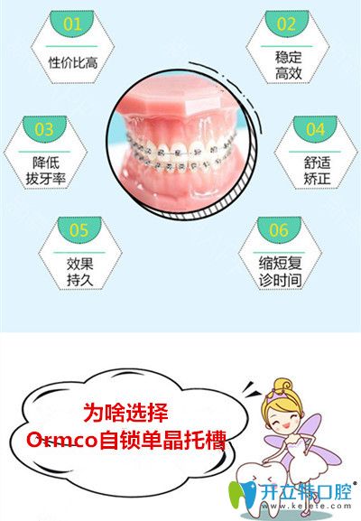 Ormco自鎖單晶托槽矯正的優(yōu)勢
