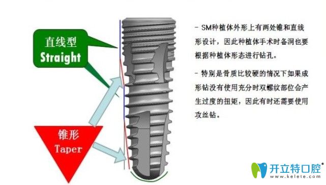10秒時(shí)間讓你了解韓國(guó)dio種植體的型號(hào)及價(jià)格是怎樣的