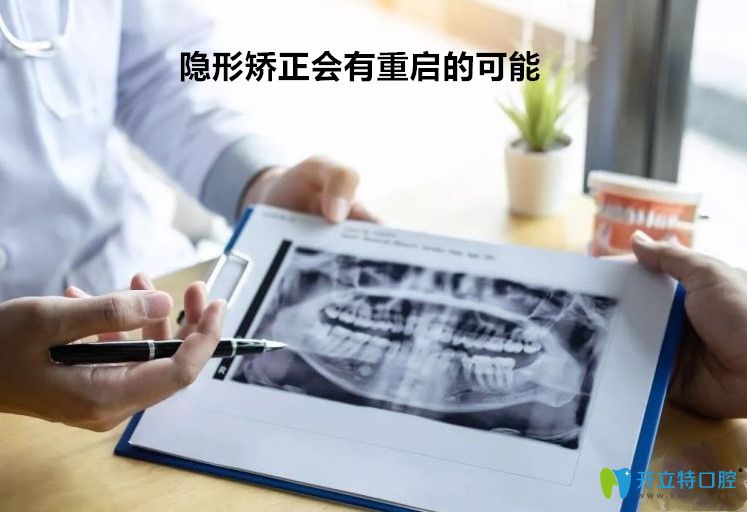 隱形矯正如果操作不當(dāng)可能導(dǎo)致重啟