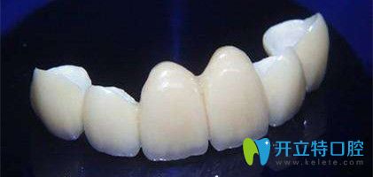 德國(guó)澤康全瓷牙
