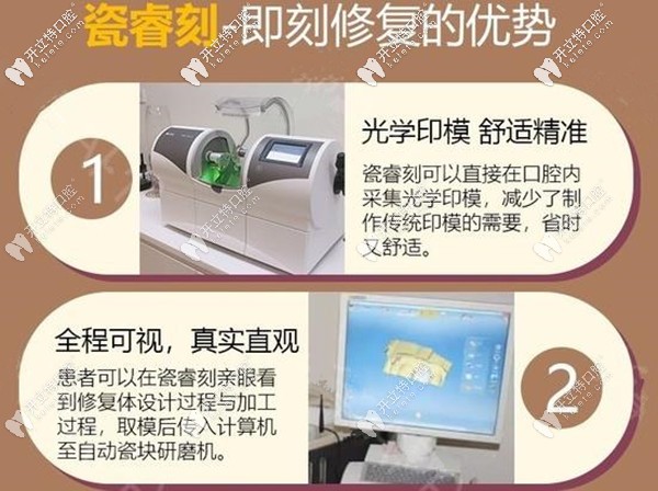 瓷?？碳纯绦迯?fù)的優(yōu)勢(shì)