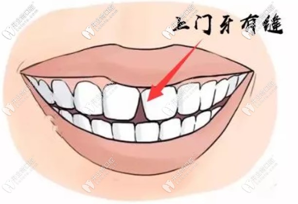 都有哪些原因?qū)е卵揽p變大