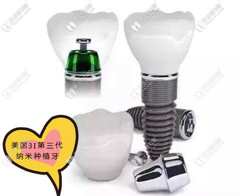 美國3I納米種植牙多少錢一顆