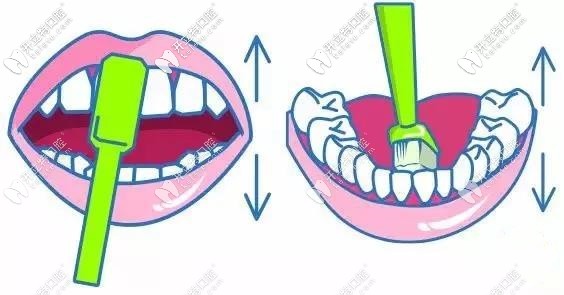 刷門牙的時(shí)候要把牙刷豎起來