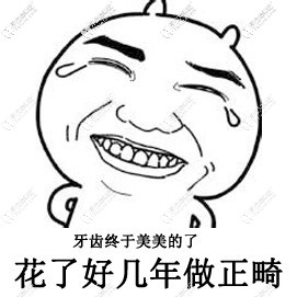 戴舌側(cè)保持器后反彈？沒想到原因竟然是它