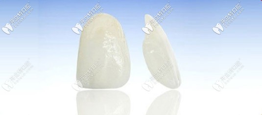 什么是全瓷貼面