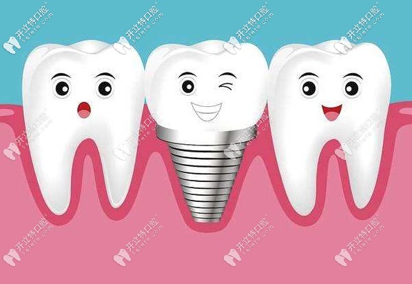 韓國(guó)登騰種植牙，種一顆送一顆