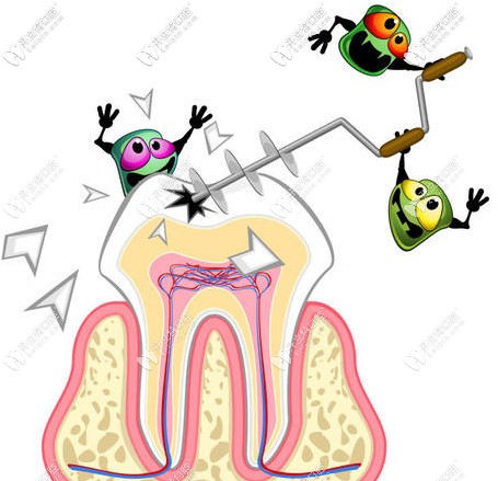 根管治療了一半該如何？