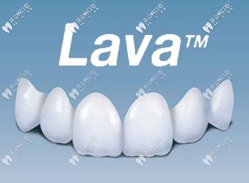 美國(guó)拉瓦全瓷牙