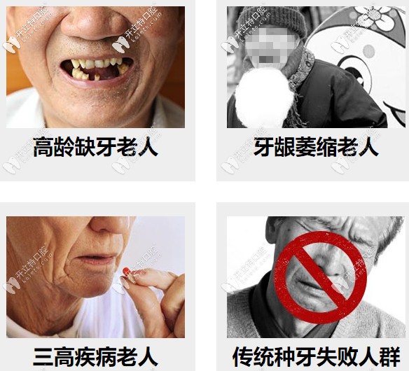 高齡缺牙、牙槽骨萎縮等都可以做種植牙