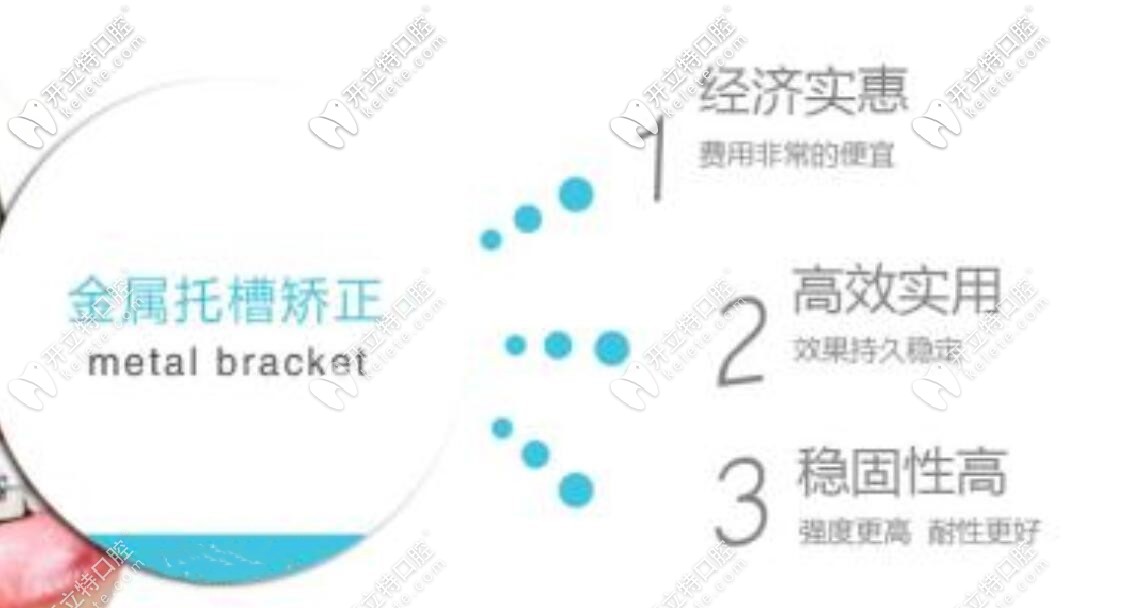 金屬矯正的優(yōu)勢(shì)