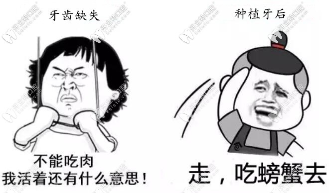 種植牙要使用一輩子,必須避開這4個坑選擇適合的種植體！