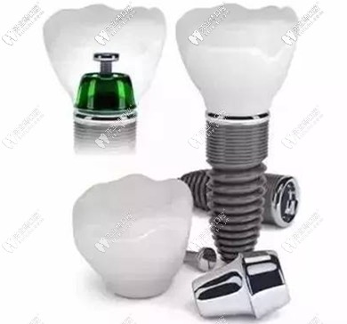 種牙選好植體是關(guān)鍵，醫(yī)生技術(shù)更關(guān)鍵