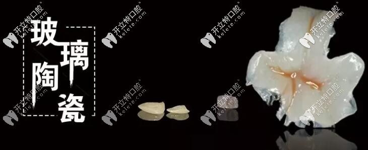 鑄瓷和玻璃陶瓷貼面竟然是材料和工藝的區(qū)別,終于弄懂了